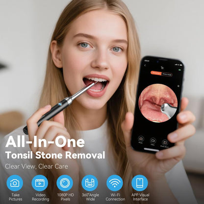 Tonsil Stone Remover Kit with Camera & Light - Wifi Connected for Ios/Android, 5 Attachments, Rechargeable (Usb/Battery), Home Oral Care Tool